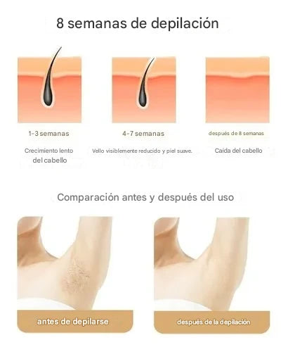Depilador Láser